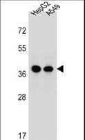 ERLIN1 / SPFH1 Antibody (aa244-273)