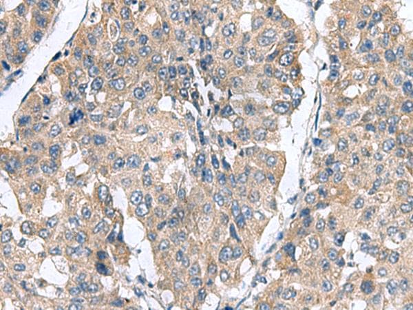 CLEC1B / CLEC-2 Antibody