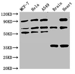 TRIM4 / RNF87 Antibody