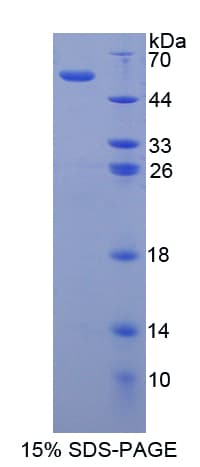 Human MMP15 Protein (Recombinant His-GST)