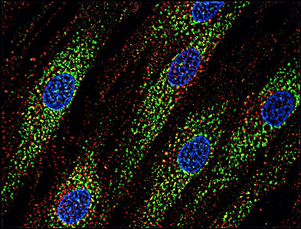 PathPlus™ CD63 Antibody (clone MEM-259)