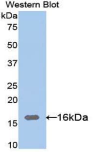 LGALS9C Antibody (aa228-356)