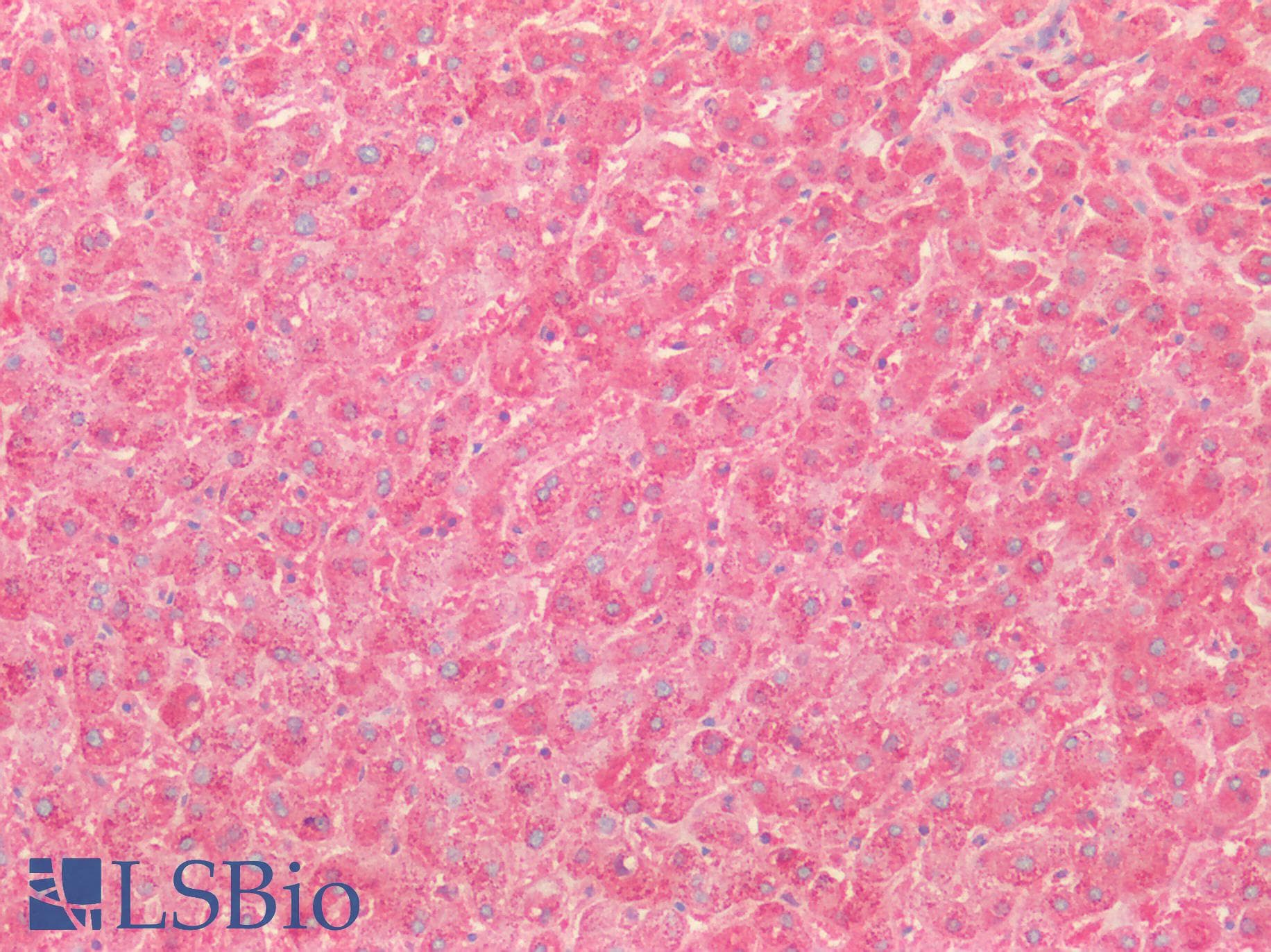 PathPlus™ SOD2 / Mn SOD Antibody (aa77-91)