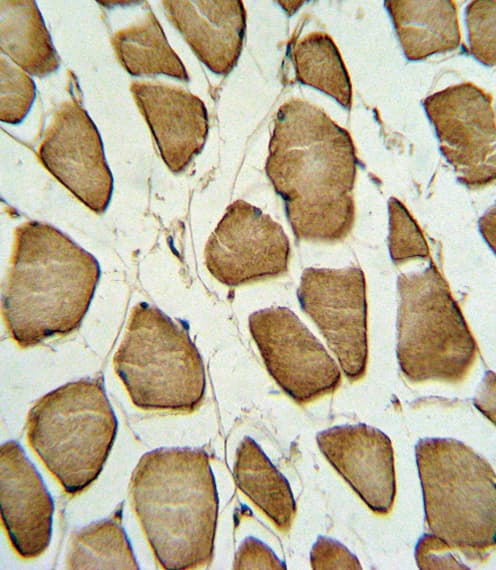 Polyclonal Rabbit anti-Human CAV3 / Caveolin 3 Antibody (aa5-31, IHC, WB)