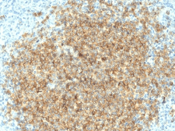 CD22 Antibody (clone BLCAM/1796)