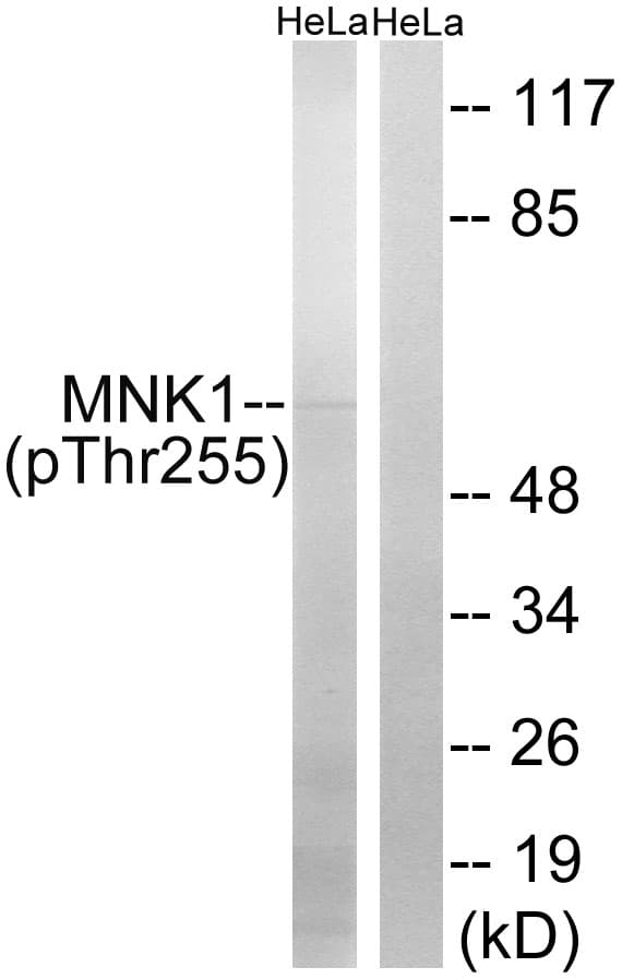 MKNK1 / MNK1 Antibody (phospho-Thr255)