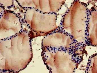 Polyclonal Rabbit anti-Human FOXN1 Antibody (IHC, WB)