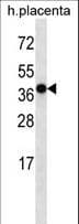 OR5H2 Antibody (aa283-312)