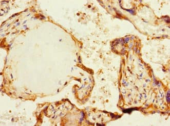 Polyclonal Rabbit anti-Human MARK1 / MARK Antibody (IHC, WB)