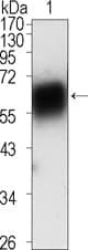 ROR1 Antibody (clone 2H6)