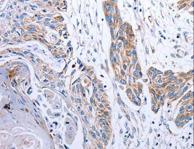 NDUFA12 / B17.2 Antibody