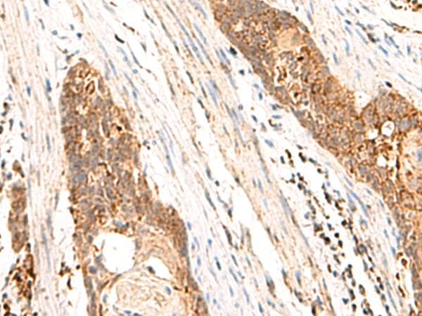 Polyclonal Rabbit anti-Human CYYR1 Antibody (IHC)