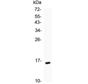 T Cell Receptor Alpha Constant Antibody