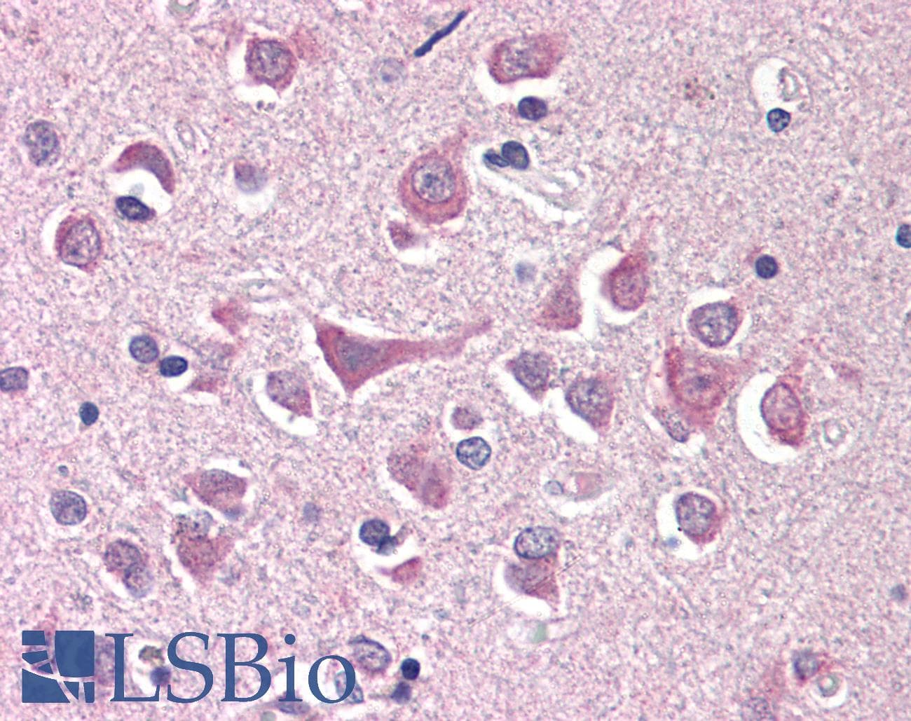 IHC-plus™ RFFL Antibody