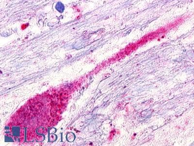 PathPlus™ GPR173 / SREB3 Antibody (Transmembrane Domain)