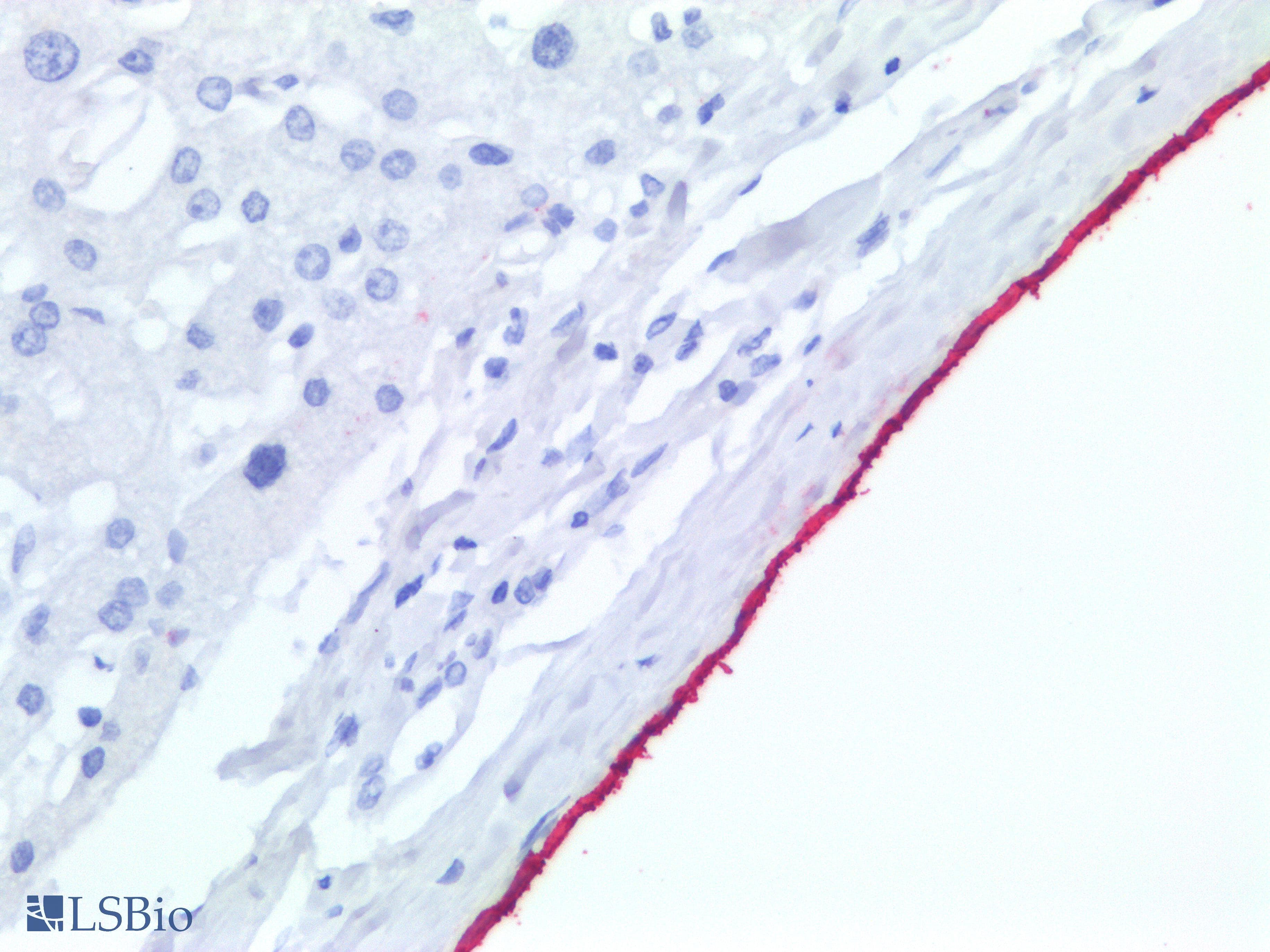 PathPlus™ Mesothelioma Antibody (clone HBME-1)