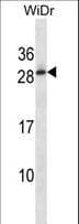 Polyclonal Rabbit anti-Human TEX40 Antibody (aa172-200, WB)