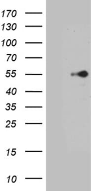 PTF1A Antibody (clone OTI5E5)