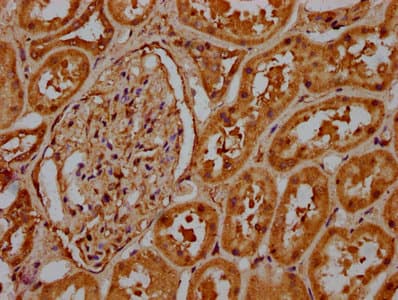 HIST1H1C Antibody