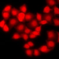 Polyclonal Rabbit anti-Human BIRC5 / Survivin Antibody (IF, WB)