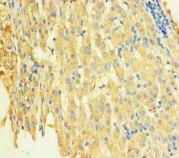 Polyclonal Rabbit anti-Human STX8 / Syntaxin 8 Antibody