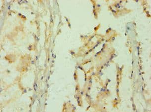 GLO1 / Glyoxalase I Antibody (aa1-184)