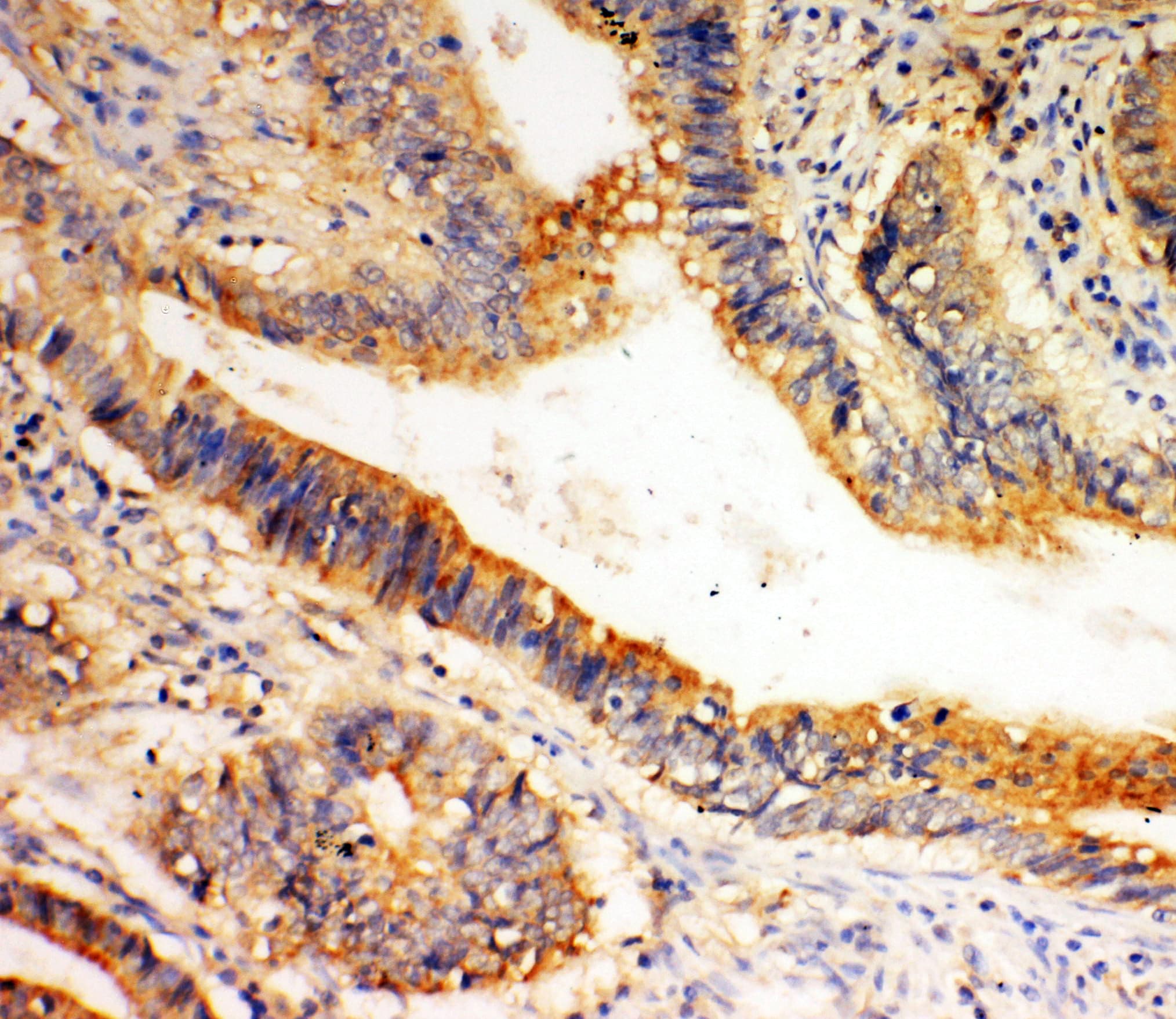 SLC1A4 / ASCT1 Antibody (aa495-512)