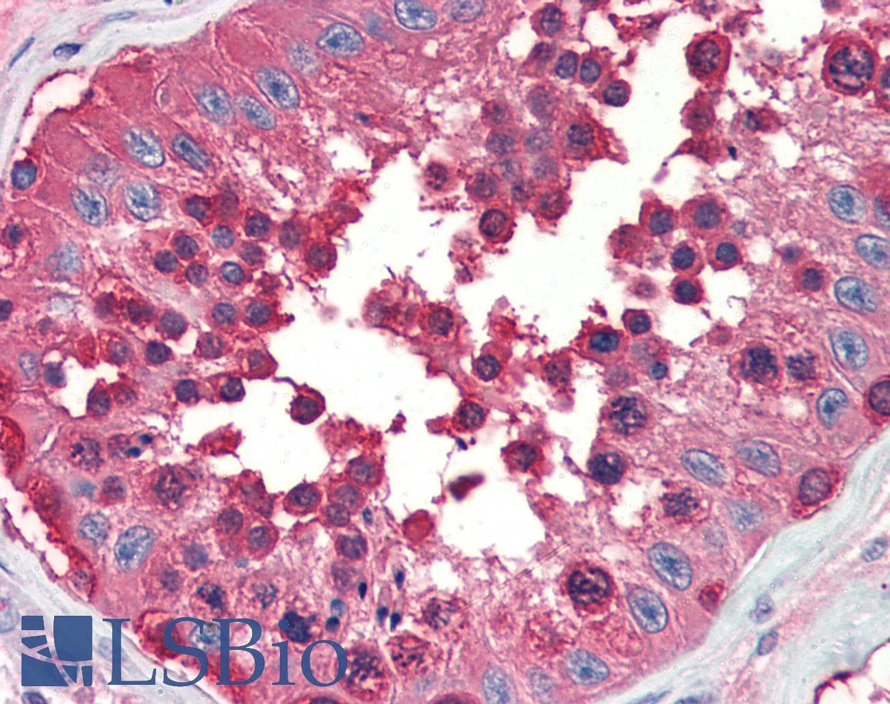 IHC-plus™ HSP90 / Heat Shock Protein 90 Antibody (clone 16F1)