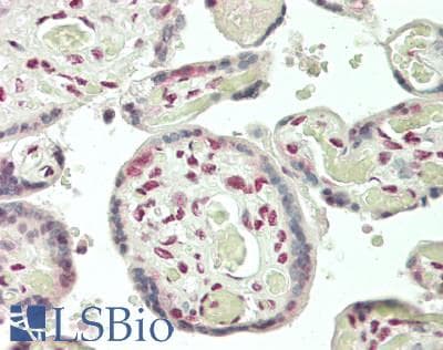 IHC-plus™ RAB3IP / RABIN3 Antibody
