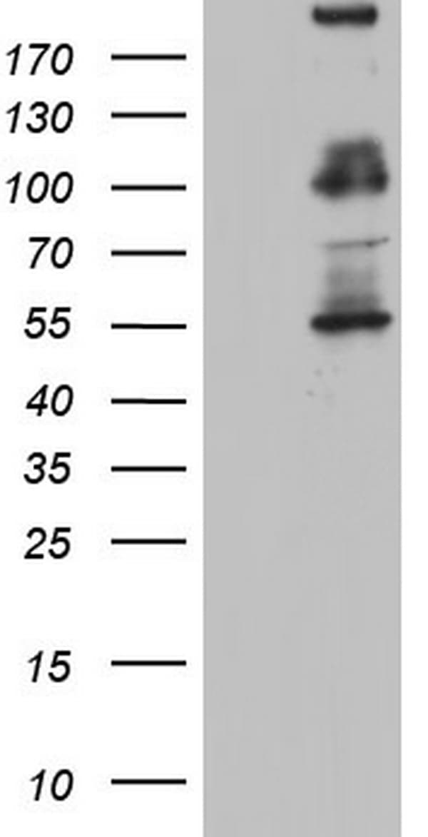 GLI / GLI1 Antibody (aa755-1106, clone OTI4C1)