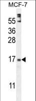 ZNF720 Antibody (aa34-62)