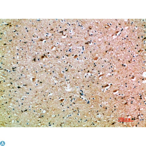 OSM / Oncostatin M Antibody