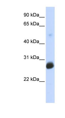 RNF186 Antibody (aa107-156)