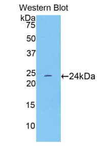 TNNI1 Antibody (aa1-187)