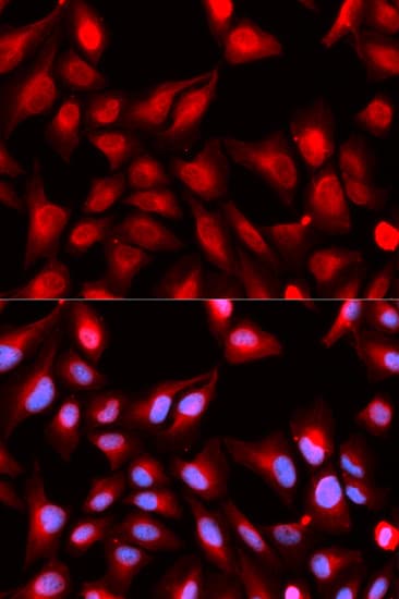 DDX5 Antibody