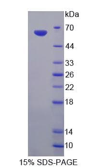 Rat Endonuclease G / ENDOG Protein (Recombinant His-GST)