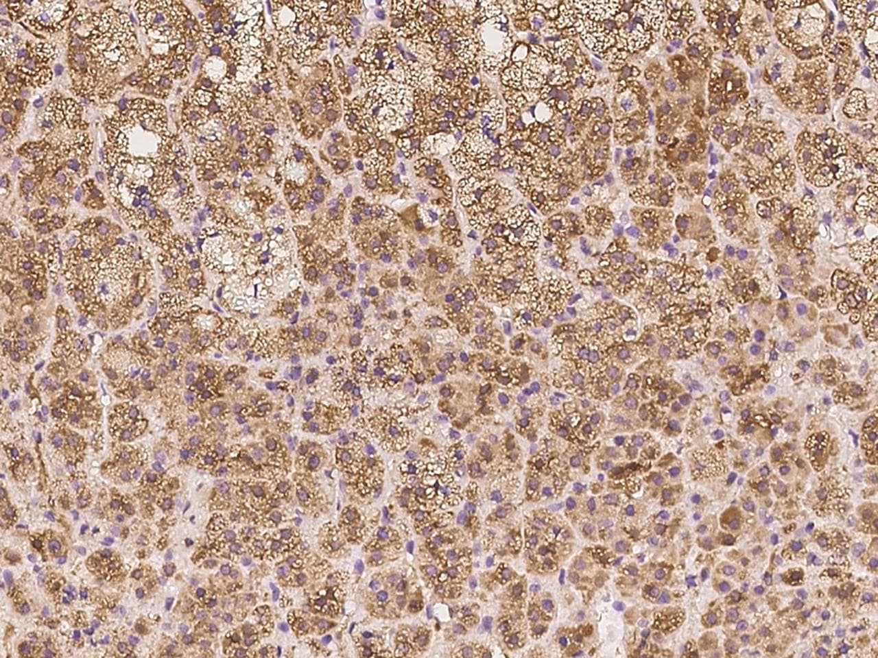 NDRG4 Antibody