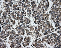 GBE1 Antibody (clone OTI4E6)