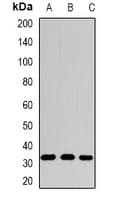 Polyclonal Rabbit anti-Human SRM / Spermidine Synthase Antibody (WB)