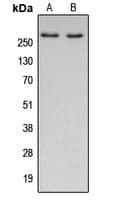PathPlus™ Polyclonal Rabbit anti-Human Acetyl-CoA Carboxylase / ACC Antibody (N-Terminus, IHC, WB)