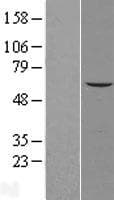 LPCAT4 Protein (Over-Expression Lysate Myc-DDK (Flag))