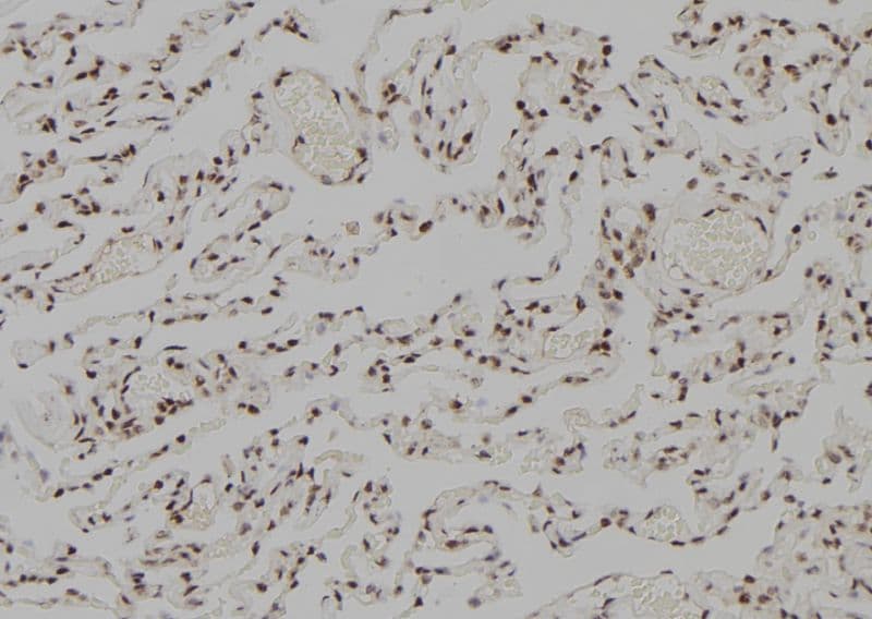 RFC5 Antibody