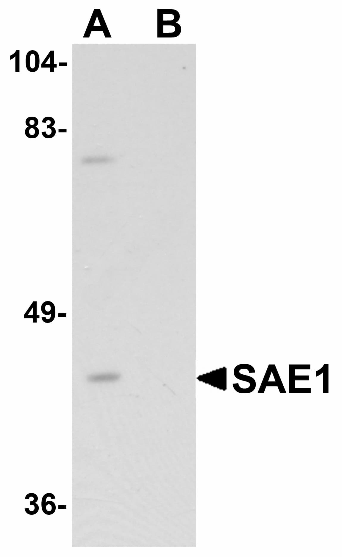 Polyclonal Rabbit anti-Human SAE1 Antibody (WB)