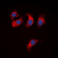 Polyclonal Rabbit anti-Human WC1 / ATP7B Antibody (N-Terminus, IHC, IF, WB)