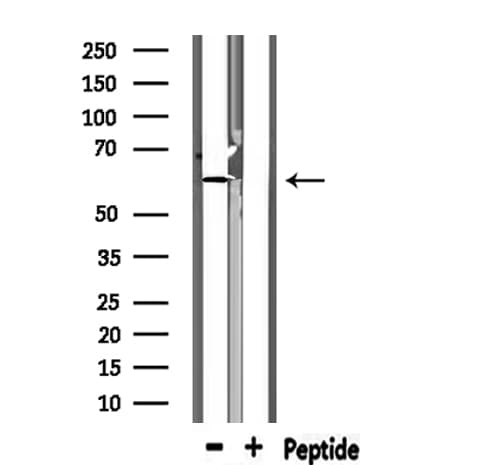 KCNQ1 / KVLQT1 Antibody