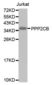 PP2CB / PPP2CB Antibody