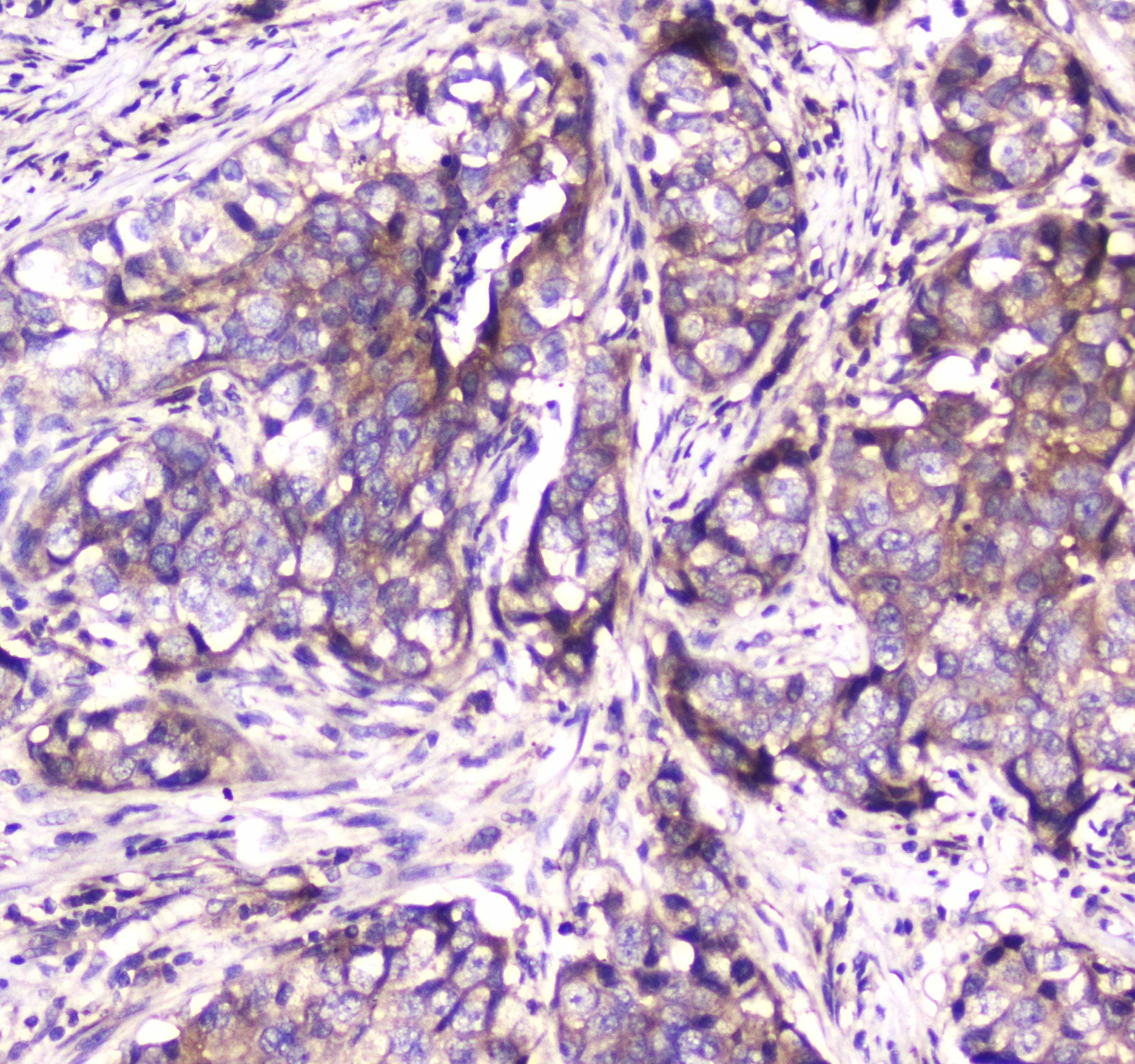 SDHB Antibody