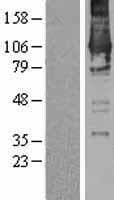 DGKZ Protein (Over-Expression Lysate Myc-DDK (Flag))