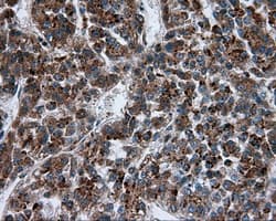 PIM2 / Pim-2 Antibody (clone OTI8G10)