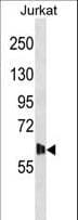DMPK / DM Antibody (aa11-39)